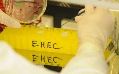 In Mecklenburg-Vorpommern: EHEC-Ausbruch: Unbekannte Infektionsquelle verursacht Besorgnis