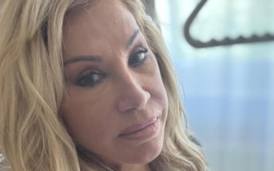 Nach heftigem Treppensturz: Carmen Geiss muss am Hirn operiert werden