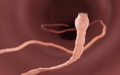 Parasiten machen krank: Gefahr im Darm: So schützt du dich vor Bandwürmern