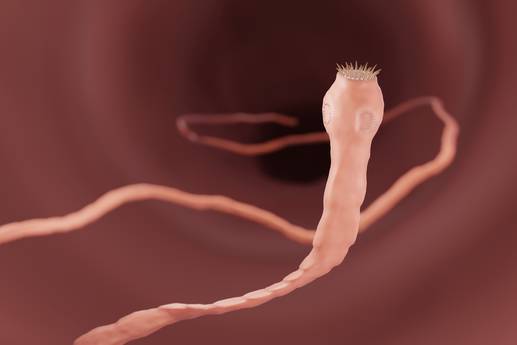 Parasiten machen krank: Gefahr im Darm: So schützt du dich vor Bandwürmern