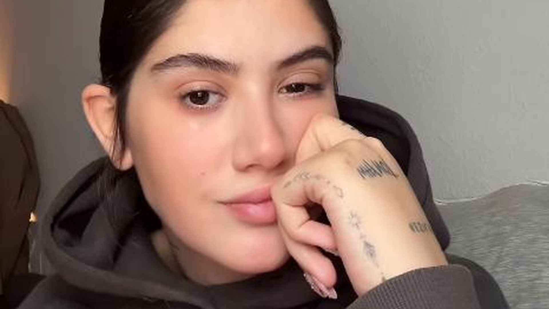 Krebsvorstufe: So steht es um Lisa Marie Akkayas Gesundheit