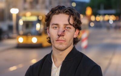 Dresden: Angreifer schlitzte sein Gesicht mit Teppichmesser auf