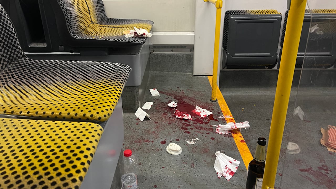Dresden: Amerikaner schützt Frau und wird brutal niedergestochen