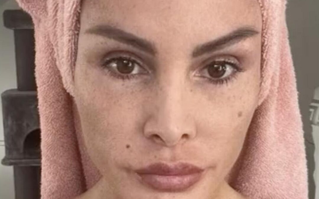 Lisha Savage dankbar: „Keine aufgedunsene Katzenfrau mehr“