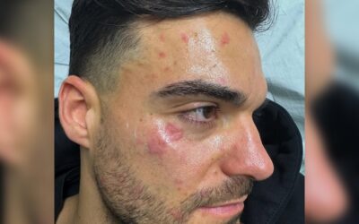 „Hatte richtig Panik“: Giovanni Zarrella bringt kleinen Bruder in Klinik