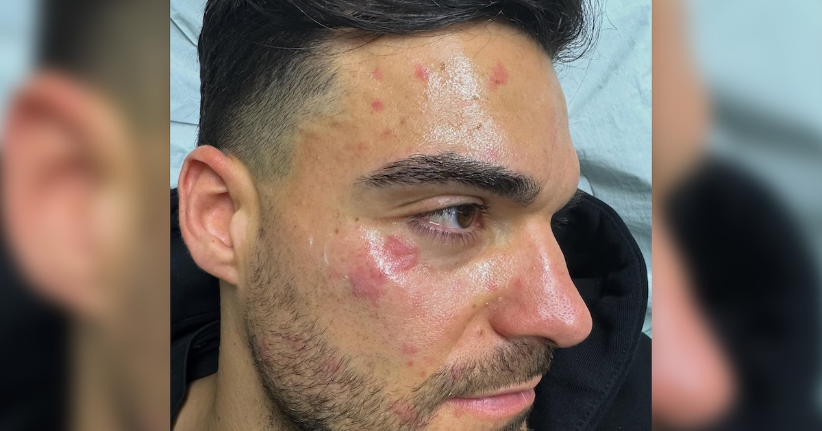 „Hatte richtig Panik“: Giovanni Zarrella bringt kleinen Bruder in Klinik