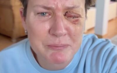 Silvester-Drama um beste Freundin von Vera Int-Veen: TV-Moderatorin böllert sich Auge weg