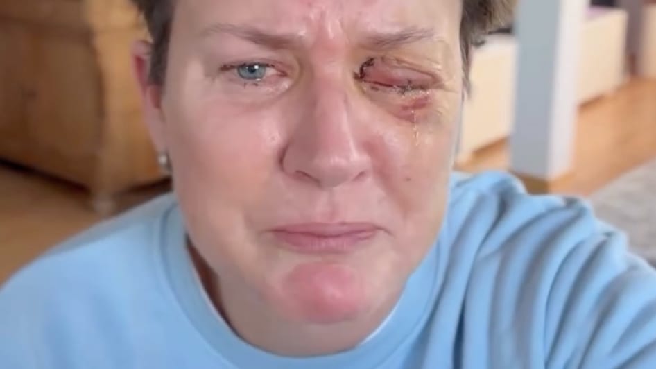 Silvester-Drama um beste Freundin von Vera Int-Veen: TV-Moderatorin böllert sich Auge weg