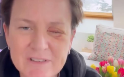 Erschreckender Böller-Unfall: TV-Moderatorin verliert ihr Augenlicht