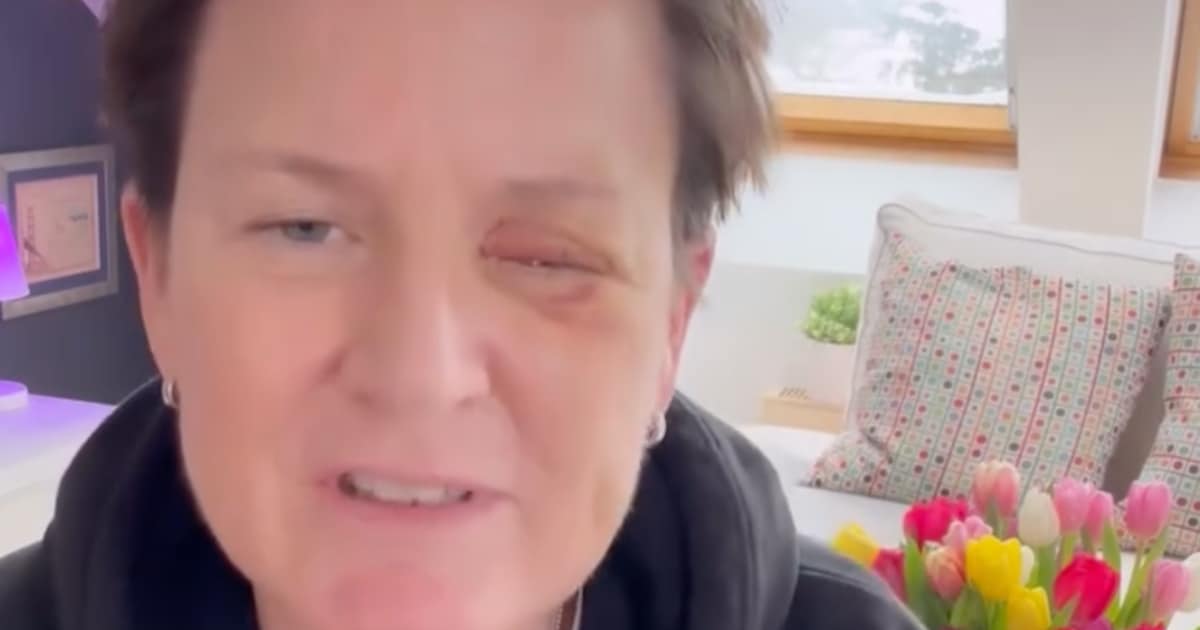 Erschreckender Böller-Unfall: TV-Moderatorin verliert ihr Augenlicht