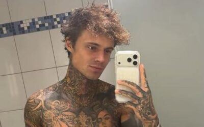 Update nach OP: Samuel Dohmen teilt Foto von XXL-Wunde