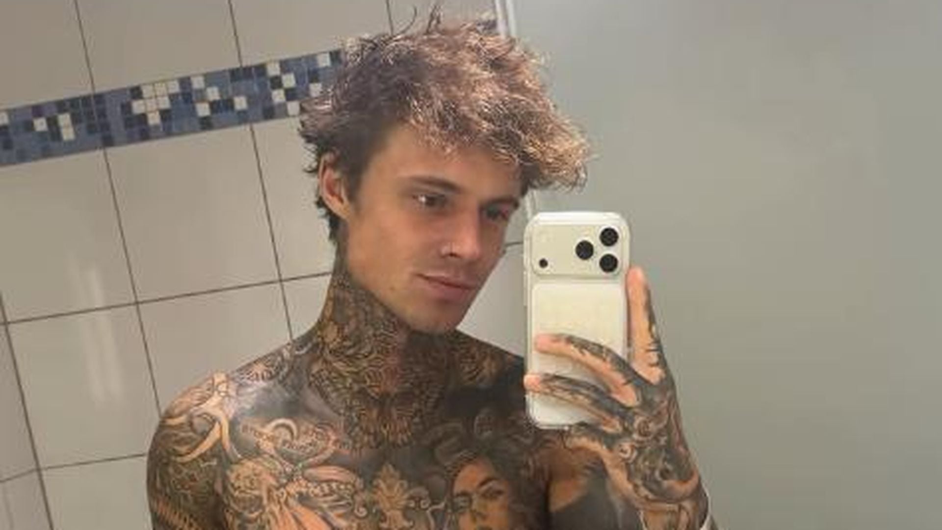 Update nach OP: Samuel Dohmen teilt Foto von XXL-Wunde